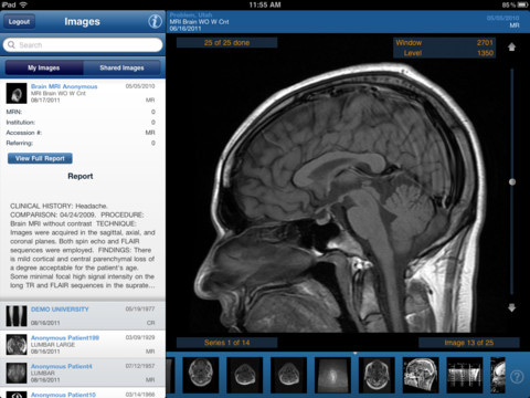 See My Radiology Mobile Application See My Radiology application, CT scan of a human skull