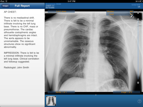 See My Radiology Mobile Application See My Radiology Application, CT scan of human lungs